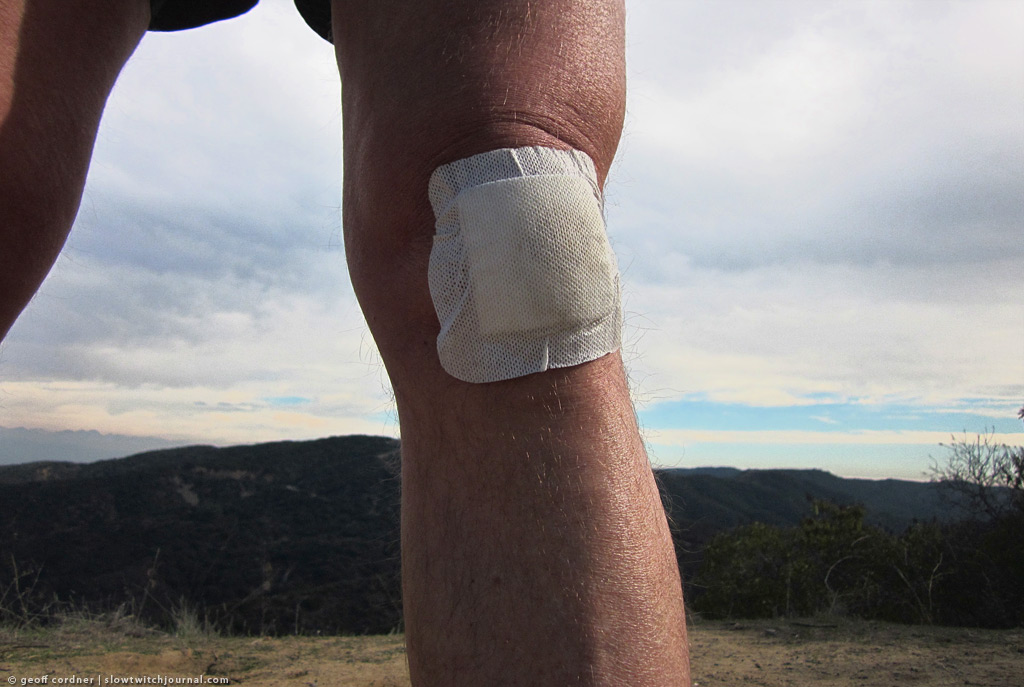 bandaged knee, Topanga