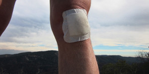 bandaged knee, Topanga